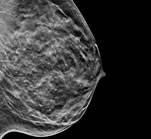 Sistema de adquisición de imágenes 2D sintetizadas C-View™ de Hologic sobre fondo blanco