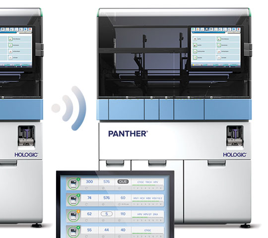 Imagen de un sistema Panther® Link de Hologic sobre fondo blanco