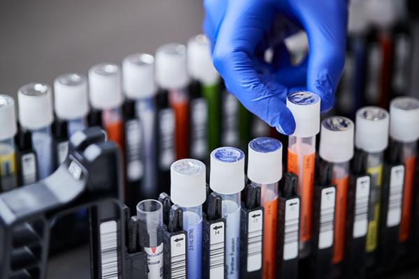 mano enguantada colocando tubos de ensayo en una bandeja