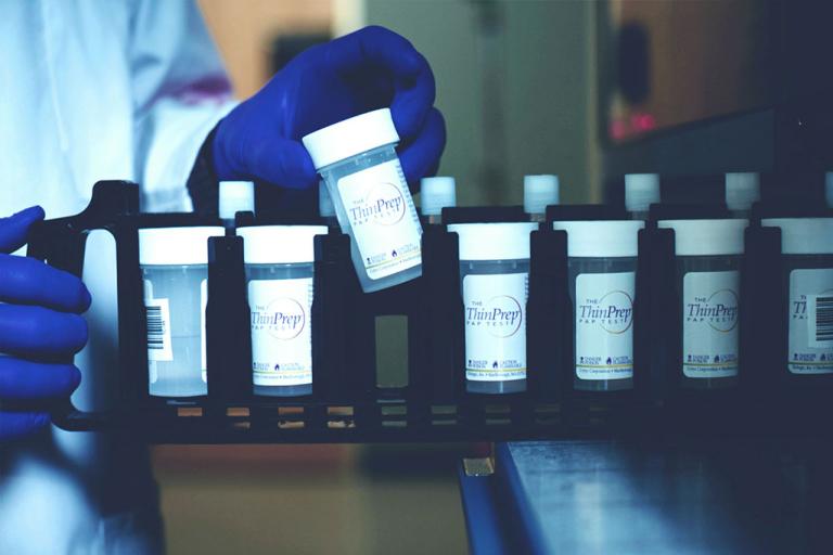 Mano con guante retirando una muestra de una bandeja