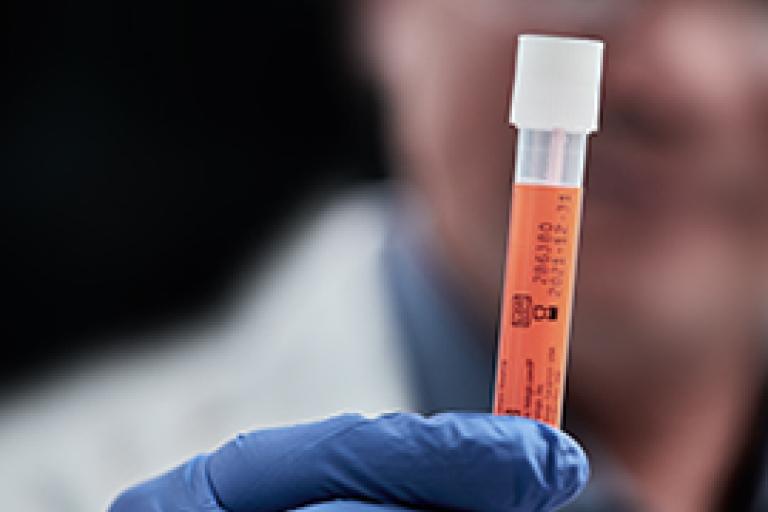 Mano con guante sosteniendo un vial