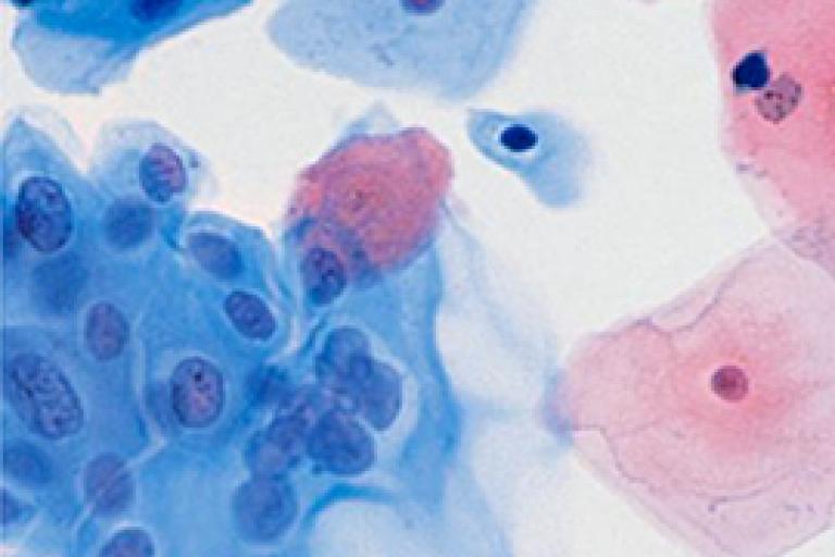 Imagen de un escáner de células		