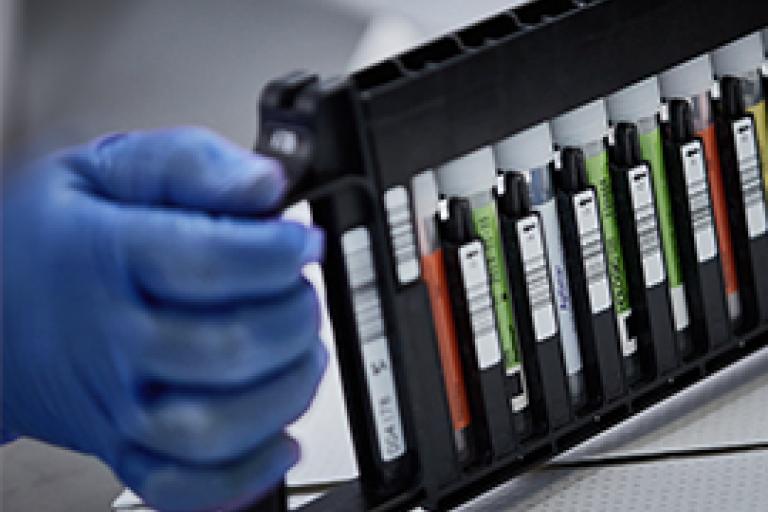 Mano con guante sosteniendo una gradilla de viales		