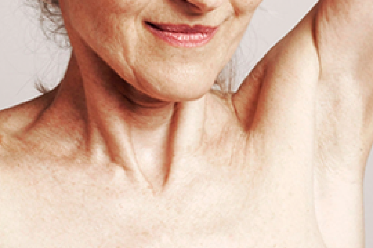 Primer plano del cuello y el hombro de una paciente preparándose para una exploración