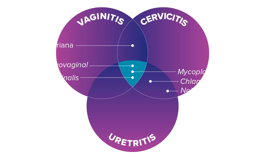 Ilustración superpuesta de vaginitis, cervicitis y uretritis