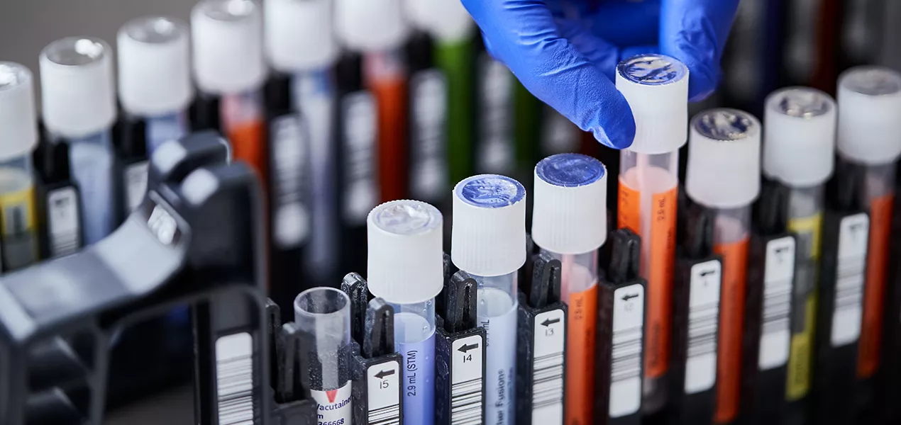 mano enguantada colocando tubos de ensayo en una bandeja