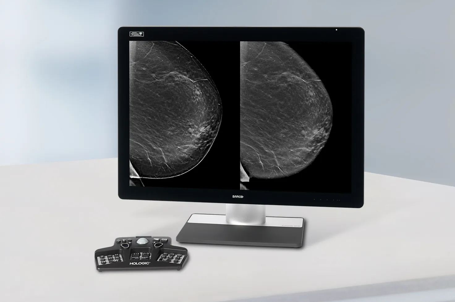 Radiografía de mama