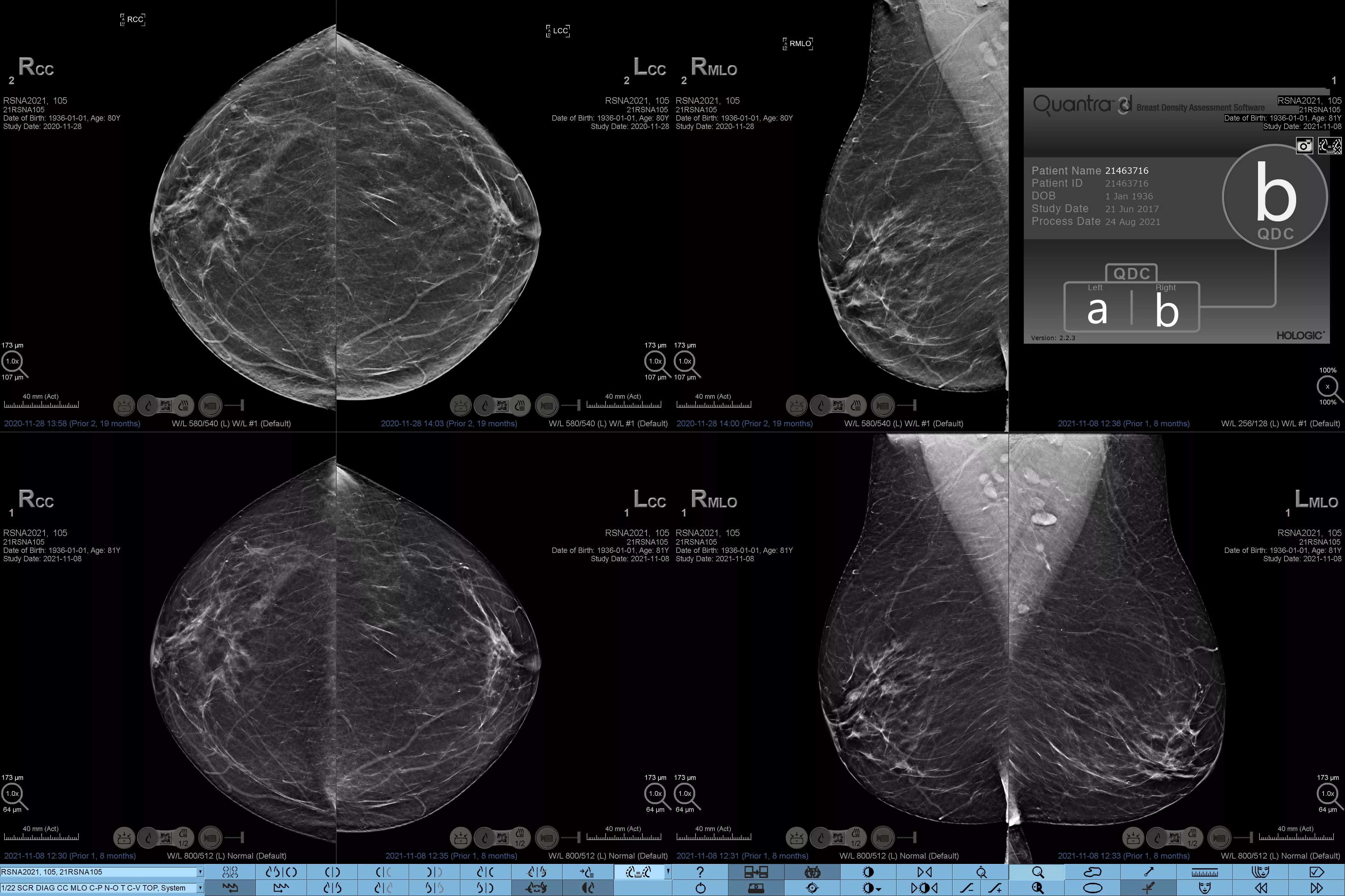 Transductor L18-5 sobre fondo blanco