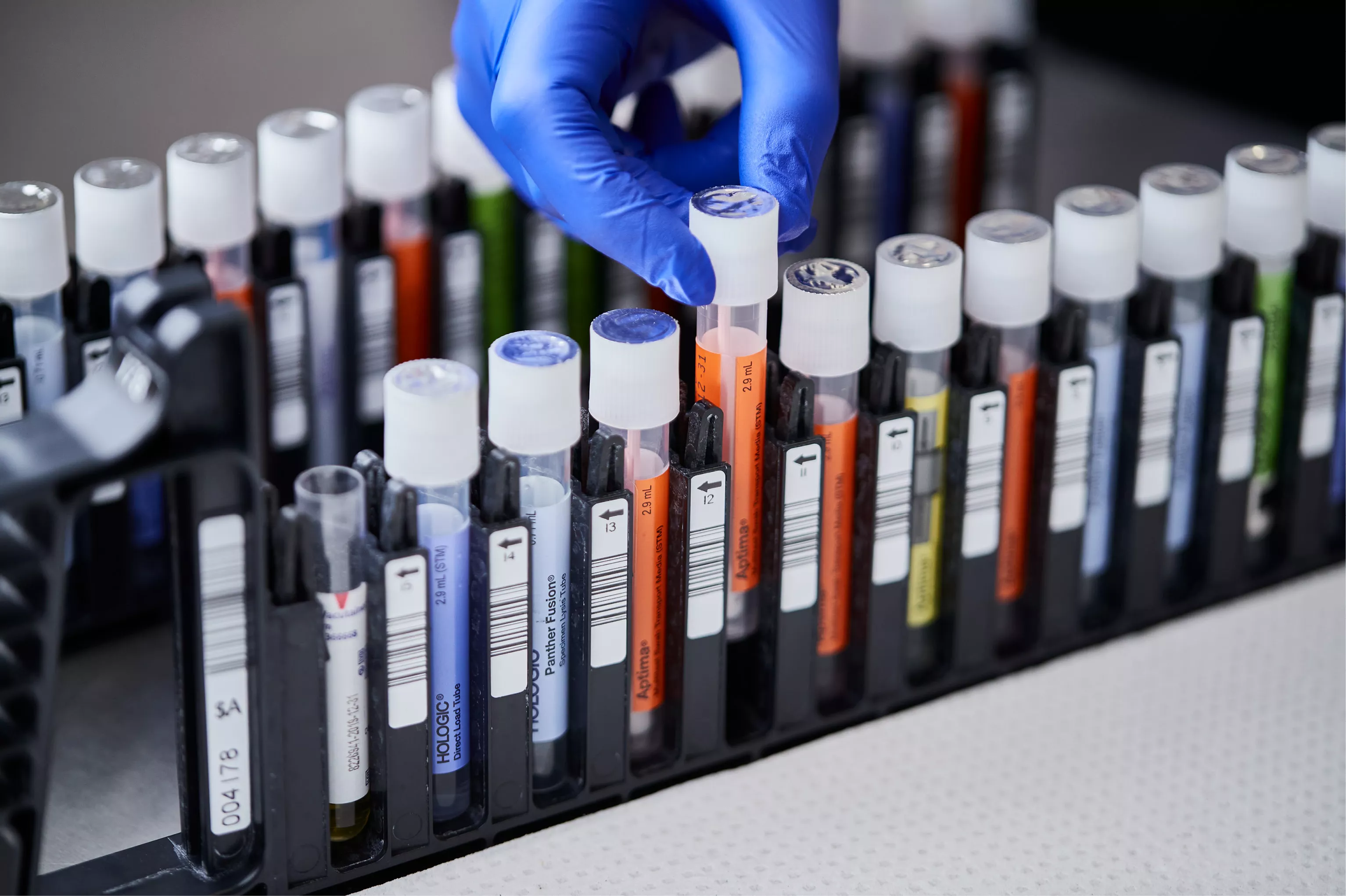 Mano con guante sacando un vial de una bandeja