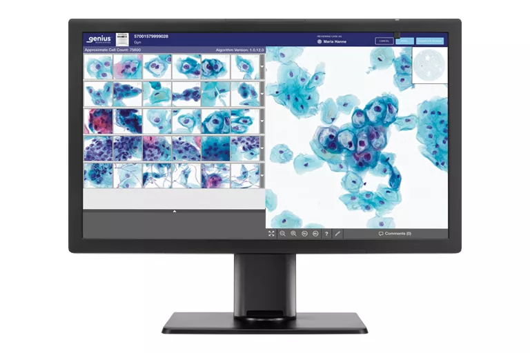 Imagen de la pantalla Genius