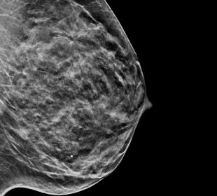 Sistema de adquisición de imágenes 2D sintetizadas C-View™ de Hologic sobre fondo blanco