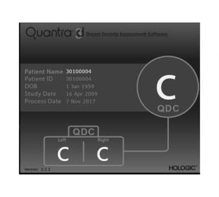 Tecnología Quantra™ de Hologic sobre fondo blanco